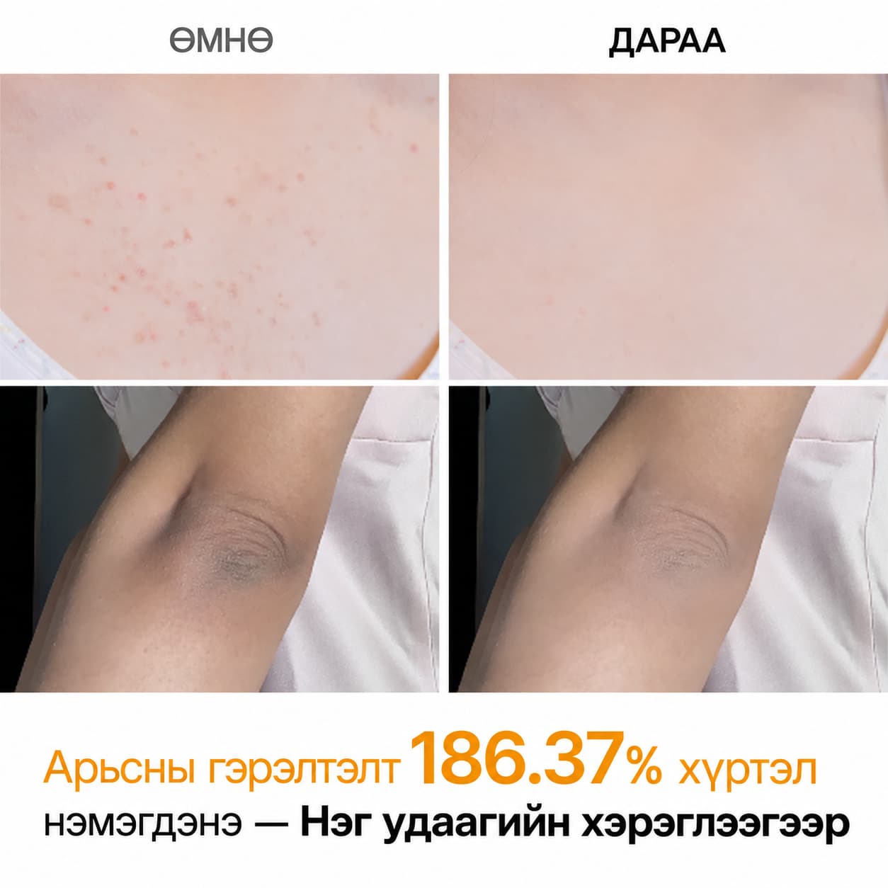 PEEL SHOT KOJIC ACID TURMERIC BODY SPRAY