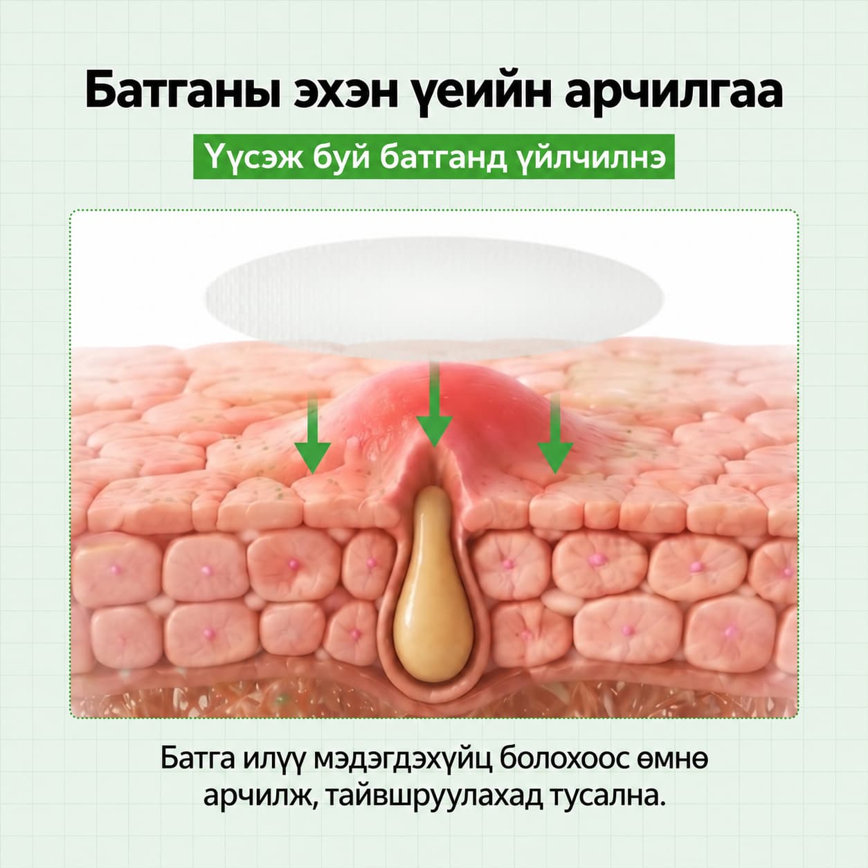 S-ZINC ZERO-FIT ULTRA THIN SPOT PATCH