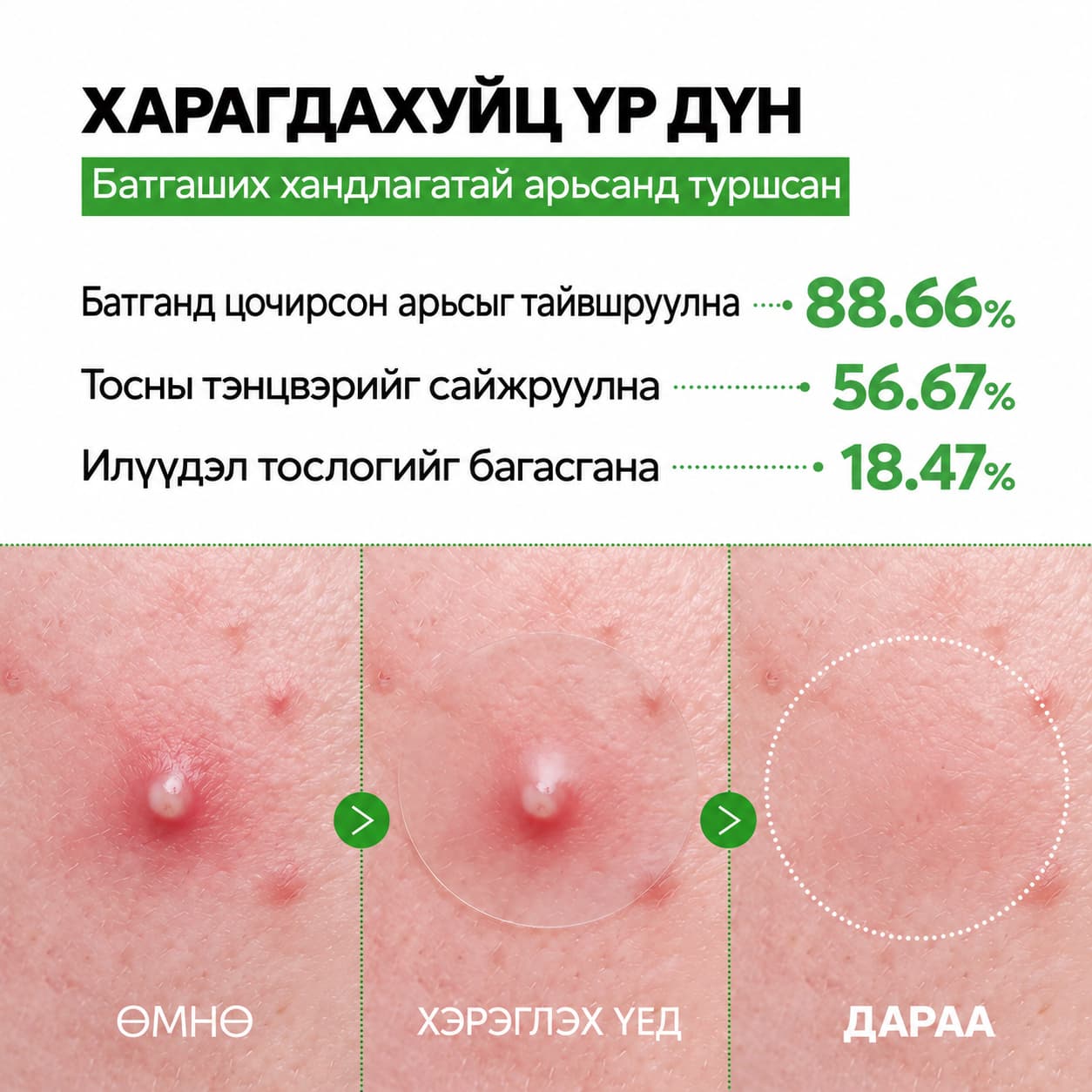 S-ZINC ZERO-FIT ULTRA THIN SPOT PATCH