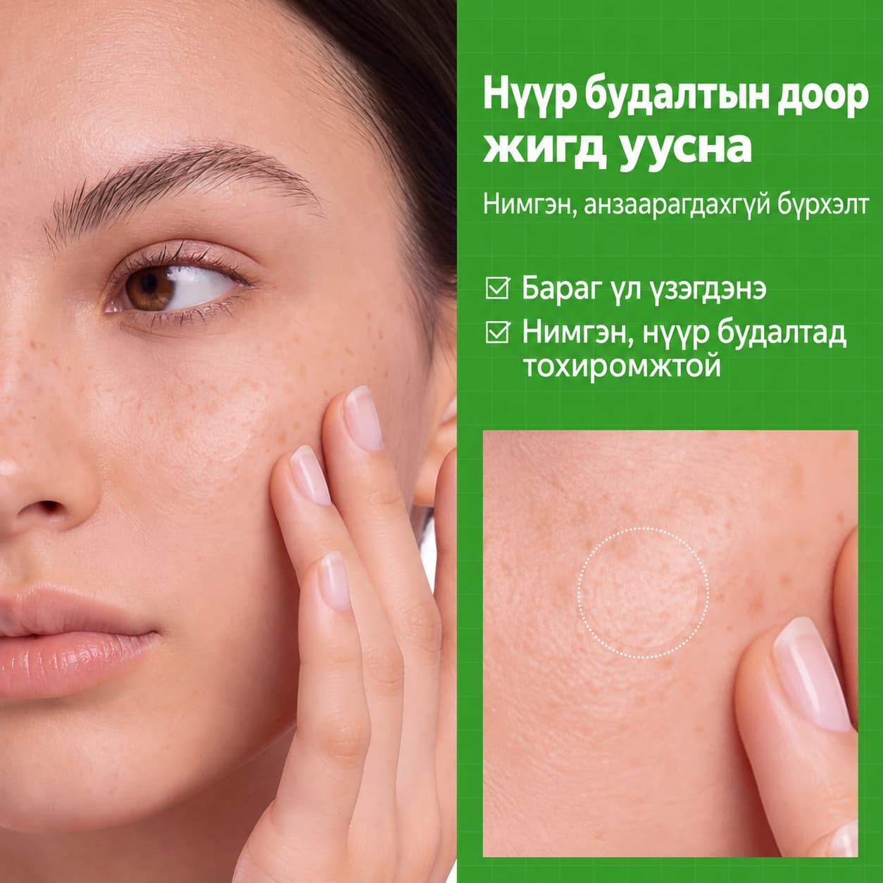 S-ZINC ZERO-FIT ULTRA THIN SPOT PATCH